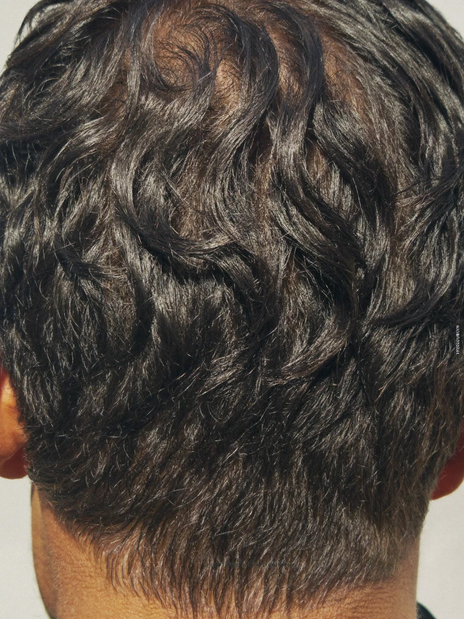 Recupera tu pelo